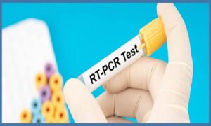 What Is the RT PCR Test and When Should You Take It?